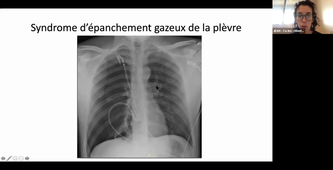 06-11-2020-DFGSM2-VOLPATO-appareil respiratoire-ED6