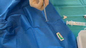 Suture pose de 3 points