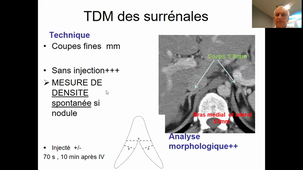 Imagerie en endocrinologie surrénale - Pr Taourel