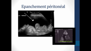 DR GENRE GRANDPIERRE UTILITE ECHO PONCTIONS VASC.mp4