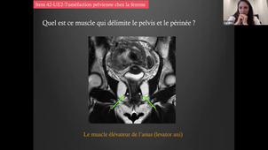 DFASM3 ATELIER 10/03/2021	15h00	16h30	Ateliers d'imagerie - imagerie néphro-uro-gynéco + radioprotection	MANDOUL Caroline	Amphi UPM	DFASM3