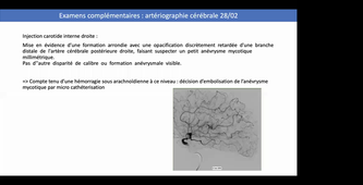 Endocardites - cas clinique - Dr ARREGLE