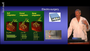 MUTTER-2-technologies de dissection et fusion tissulaires.mp4