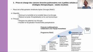 Classe virtuelle - Poumon / Oncologie thoracique (Dr Q. THOMAS, ICM Montpellier)