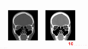 DFASM1 best of Bloc A DFA1 ORL/ophtalmo/CMF/Ortho