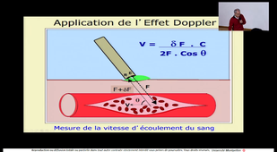 07 - Bases du doppler 1-2