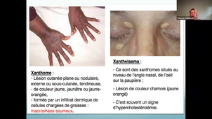 DFGSM3 - Maladies de surcharge réparation tissulaire - Lacheretz - 30/09/2026