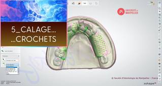 3SHAPE2025_PPAM MD 05 calage & crochets.mp4