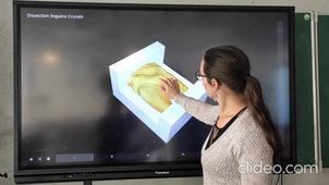 Visualization of inguinal and femoral regions virtual dissection with Inside Explorer