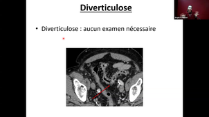 DFGSM3 UE : H.G.E. - CM7 Indication de l'imagerie en pathologie abdominale et digestive - Amphithéâtre Rondelet - Tessa Ferrari - 27/03/2026