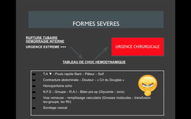 DFASM2 MIE 06/01/2021	14:00	15:00	Grossesse extra utérine	COMPAN Clara	TD308	MIE