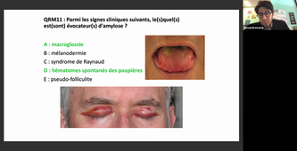 DFASM2 MIF 10/03/2021	10:00	12:00	Amylose	MARIA A.	Salle 309	3563247141	MIF