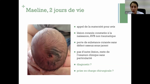 DU de chirurgie plastique pédiatrique Dr Anissa Belkhou, Chirurgie du cuir chevelu 03/02/2021