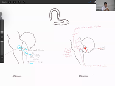 02-10-24-DFGSM2-Appareil neuro-M Bertrand-CM11.mp4