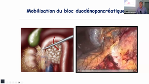 VIDEO A DECOUPER.mp4