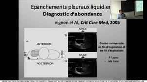 DIU TMUS / Dr Bonnec Échographie pulmonaire 2