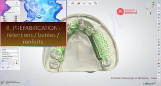 3SHAPE2025_PPAM MD 08 préfabrication.mp4