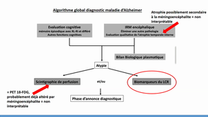 DFASM2 CONF 16/03/2021	18:30	20:30	Conférence DFASM2 Neurologie 1	SAVENIER Florian	Amphi UPM	DFASM2