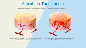 Oncogenese_Pr Jean-Pierre Delord