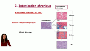 ethanol-symptomatologie.mp4