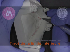 L3 * PPAM MANDIBULAIRE * LIMITES d'ARMATURE ET DEPARTS DE CONNEXION