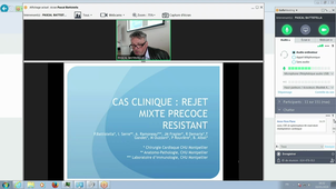 DU Battistella Insuffisance Cardiaque Pr Batistella Cas cliniques 2 10 Mai 2019