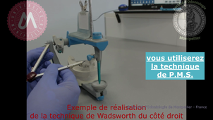 F2_Tracé courbe d'occlusion idéale_TP.mp4