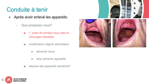 CM2529_HACQUARD MA_Cas clinique la blessure buccale.mp4