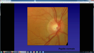 DFASM1 MID - Ophtalmo Pierre Pineau 2/2 (01/10/2020)
