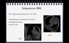 IRM - cardiaque - Dr SOULLIER