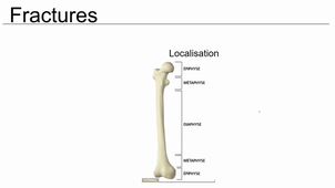 Mercredi	05/01/2022	17:00	18:00	ORTHOPEDIE	QR	B COULET	AMPHI LAPEYRONIE