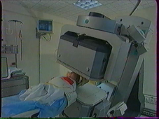 Epilepsies : Syndrome de WEST