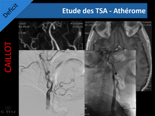 Urgences neuroradiologiques non traumatiques