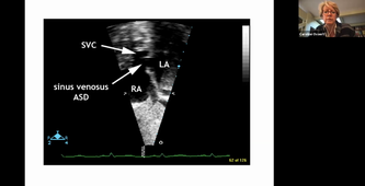 Cardiopathies de l'enfant - Dr OVAERT