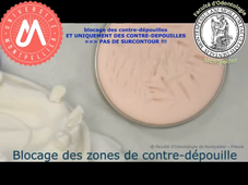 C2_cire de blocage_MAND_MDL.mp4