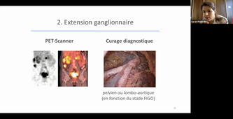 DFASM2 MIE 04/11 L REBEL