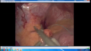 DU PEC Obésité 2018 Coste