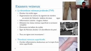 05/10/2022	13h30	14h30 	Appareil cardiovasculaire - CM21/22	Dr HUE Yoann	Amphi UPM	DFGSM3