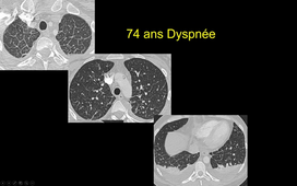 DFASM3-Atelier Imagerie Neuro-ORL-OPH-Menjot De Champfleur Nicolas et Bommard Sébastien