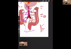 18-02-25-DFGSM2-Appareil digestif-CM5-M Prudhomme.mp4