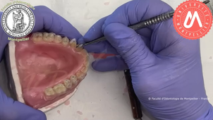 2023VB_montage MAX_dents postérieures.mp4