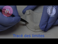 D1_M.O. maxillaire_tracé des limites